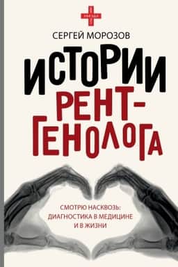 Cover: Istorii rentgenologa. Smotryu naskvoz′: diagnostika v medicine i v zhizni.