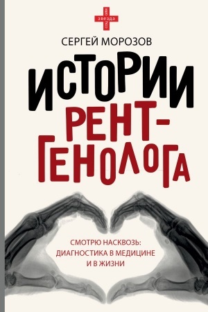 Cover: Istorii rentgenologa. Smotryu naskvoz′: diagnostika v medicine i v zhizni.
