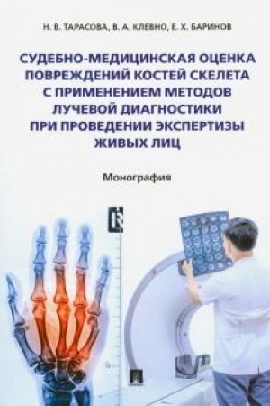 Cover: Sudebno-medicinskaya ocenka povrezhdenij kostej skeleta s primeneniem metodov luchevoj diagnostiki pri provedenii ekspertizy zhivych lic.Monografiya.
